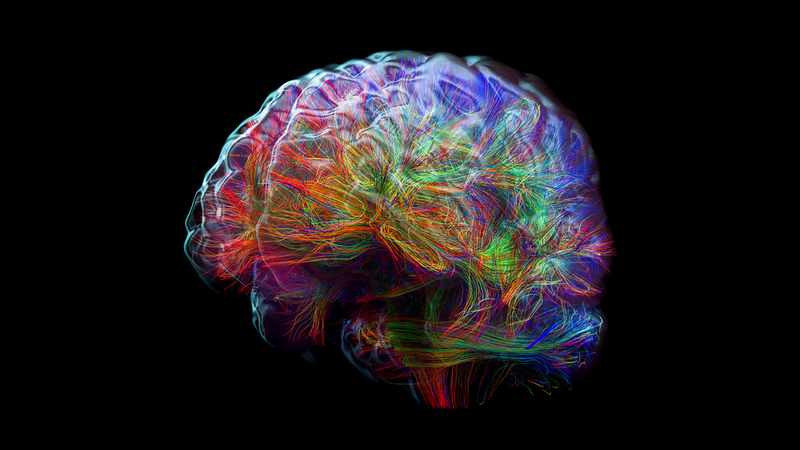 cerebro